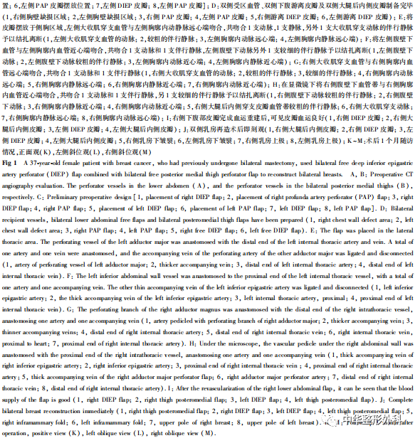 640 (1).png